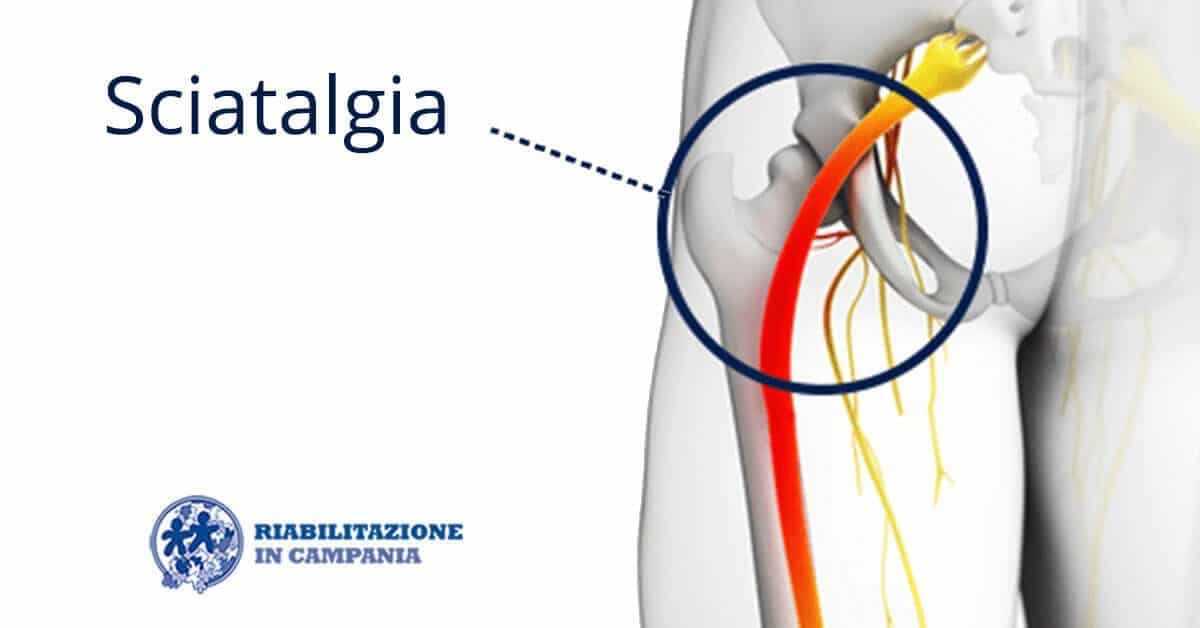 sciatalgia-riabilitazione-campania-sito-1200x628